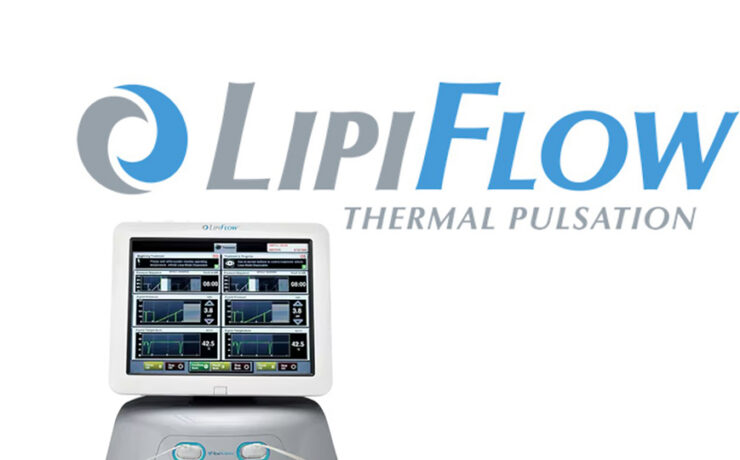 Lipiflow for Dry Eye