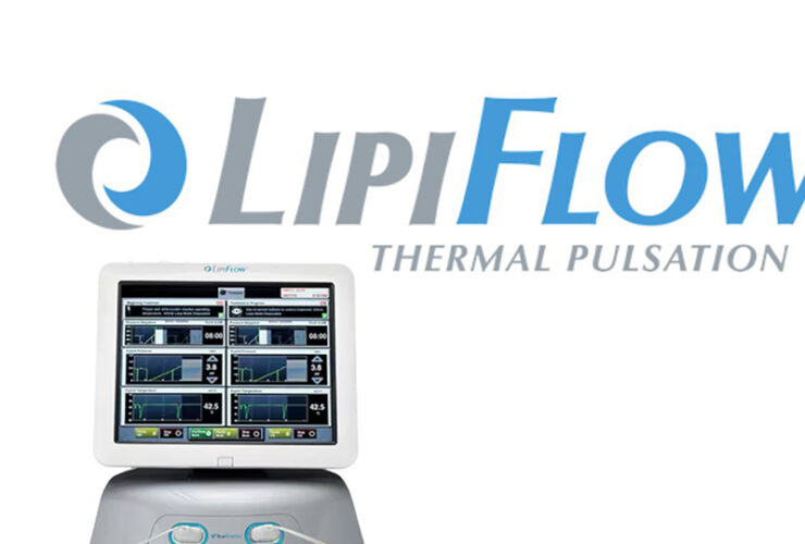 Lipiflow for Dry Eye