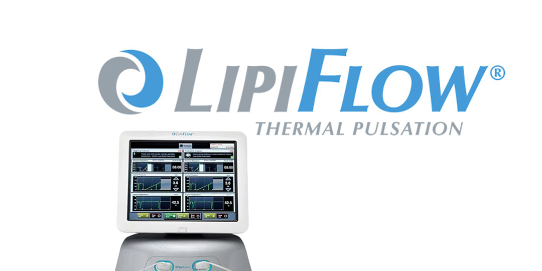 Lipiflow for Dry Eye